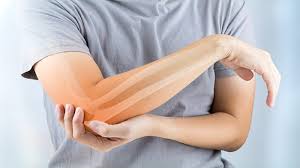 forum artroplastike zgloba koljena